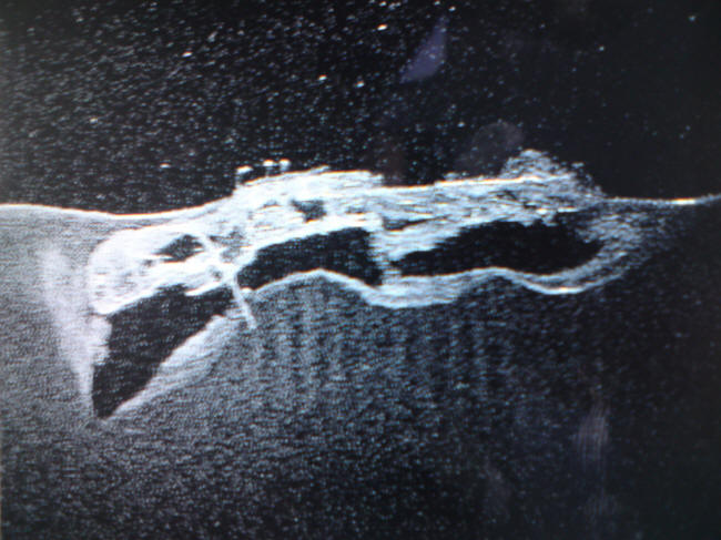Sonar billede af Robert